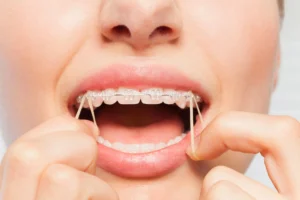 patient seeing an orthodontist palm beach gardens