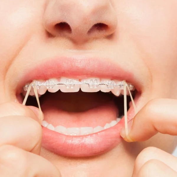 patient seeing an orthodontist palm beach gardens