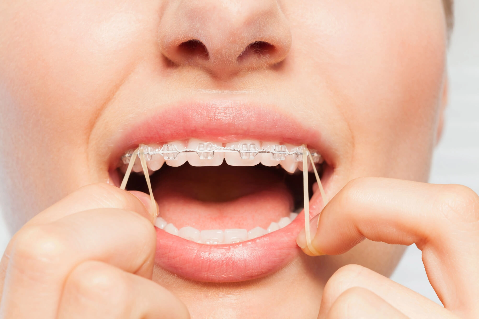 patient seeing an orthodontist palm beach gardens