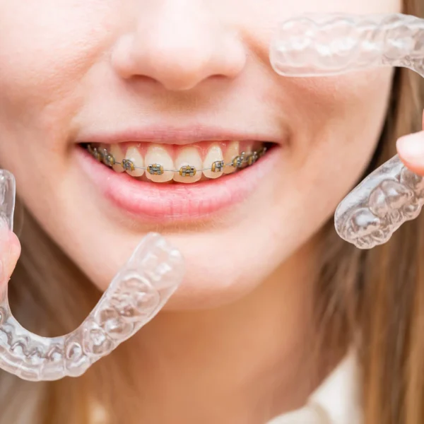 Smiling girl with braces holding removable Invisalign-mandibular-advancement-transparent-aligners.