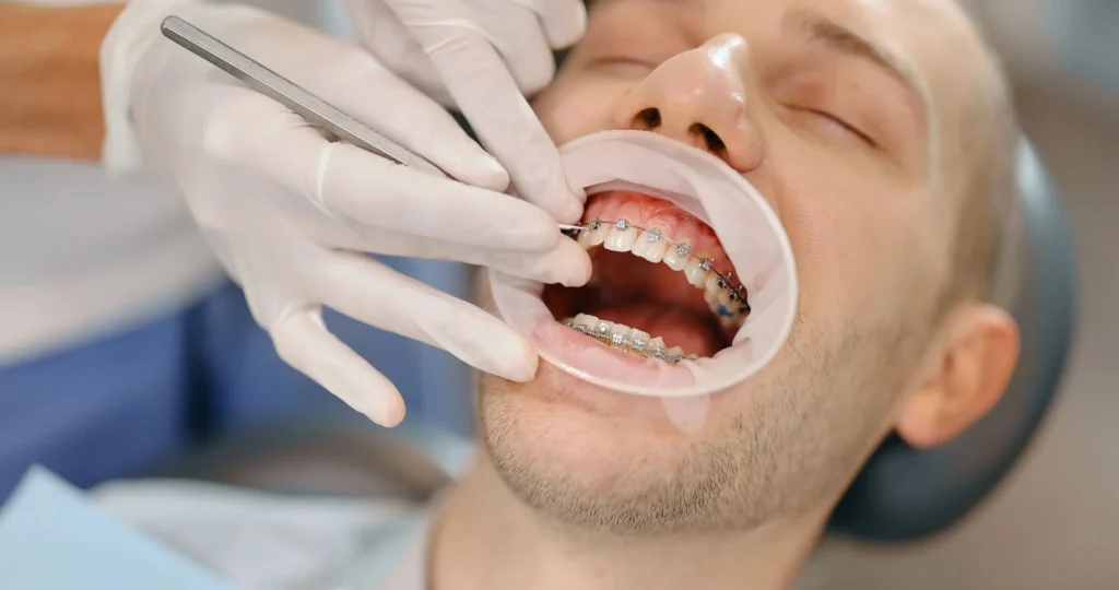 Male patient with braces visiting the best orthodontist for adults near you