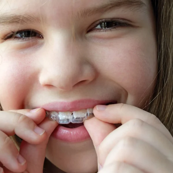 Teen adjusting clear aligners for early orthodontic treatment near you