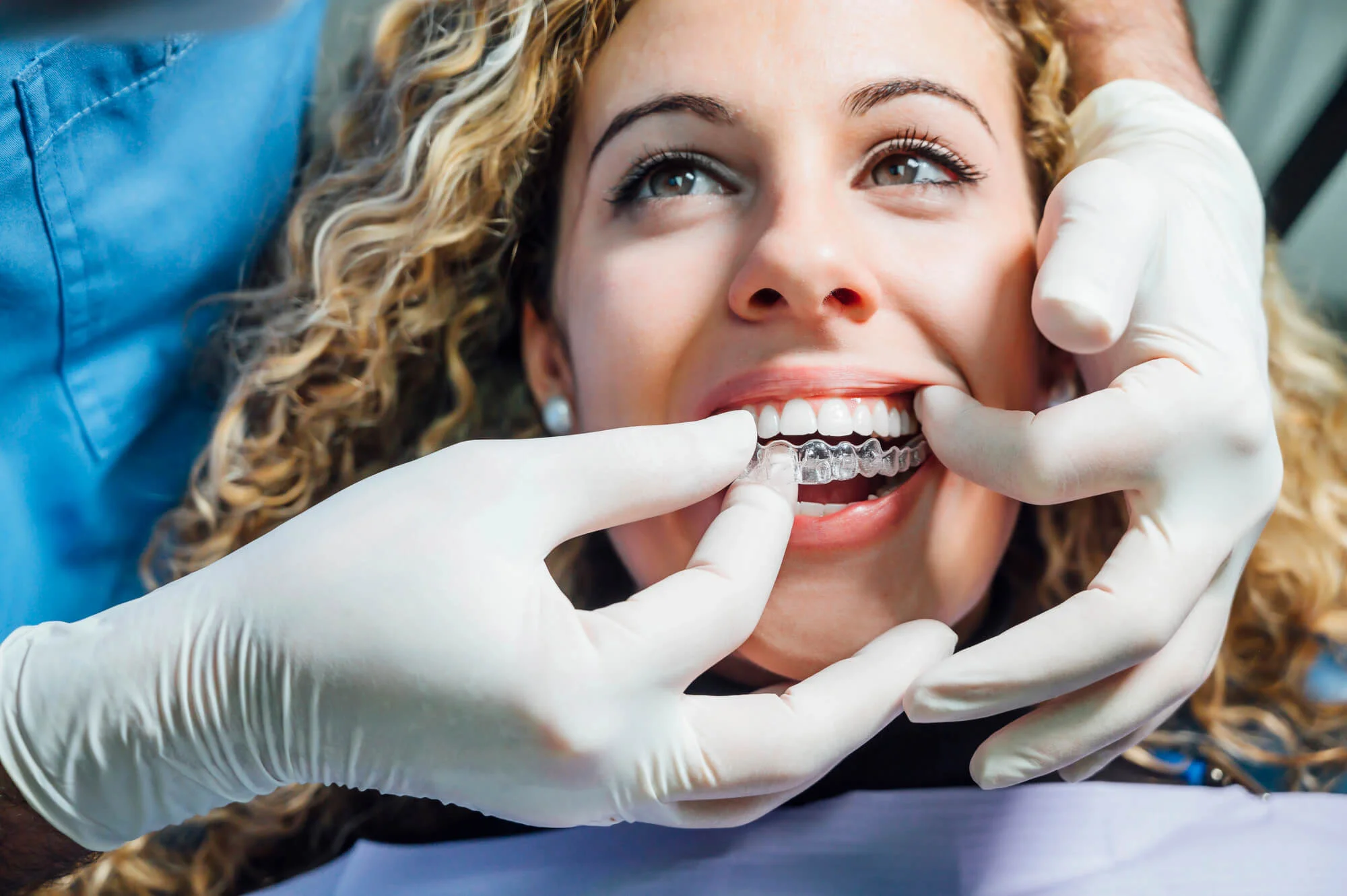 Aligners being placed by a dentist in West Palm Beach.