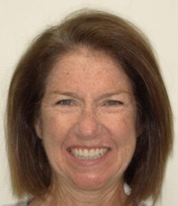 240006 - Nancy Poppe - Final - Facial Front Smiling