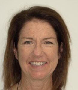 240006 - Nancy Poppe - Initial - Facial Front Smiling