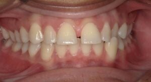 240047 - BONITA ROACHE - Initial - Intraoral Center