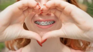 Young Woman Smiling with Ceramic Braces vs Metal Braces