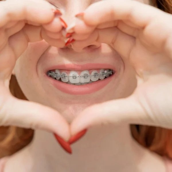 Young Woman Smiling with Ceramic Braces vs Metal Braces