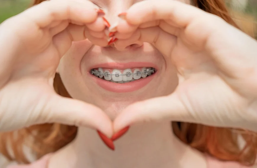 Young Woman Smiling with Ceramic Braces vs Metal Braces