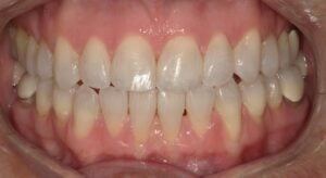 240006 - Nancy Poppe - Final - Intraoral Center
