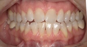 240006 - Nancy Poppe - Initial - Intraoral Center