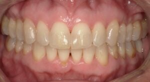 250102 - Cheryl Algeria - Final - Intraoral Center