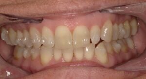 250102 - Cheryl Algeria - Initial - Intraoral Center